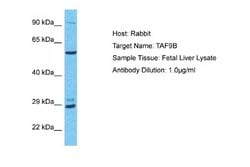 TAF9b Antibody, Novus Biologicals 100 &mu;L; Unconjugated:Antibodies, Polyclonal